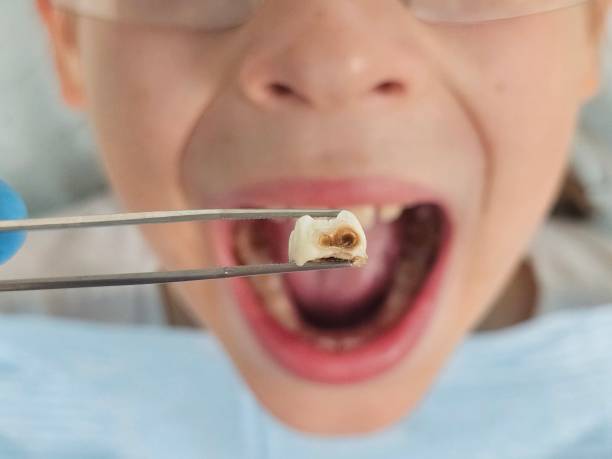 Best Emergency Gum Pain Relief  in Turpin Hills, OH